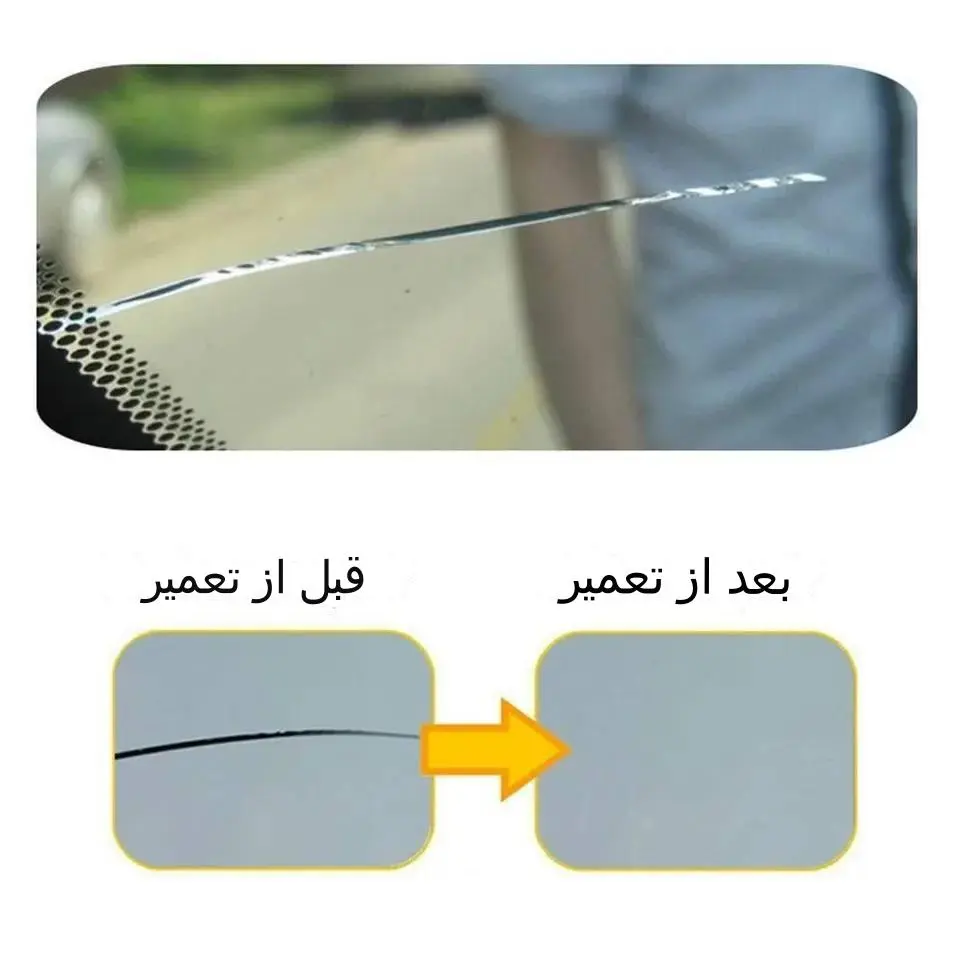 قبل-و-بعد-از-ترمیم